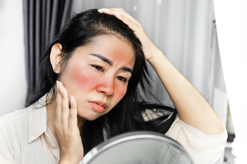 manfaat niacinamide untuk kulit wajah