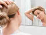 5 Penyebab Jerawat di Kepala dan Cara Mengobatinya